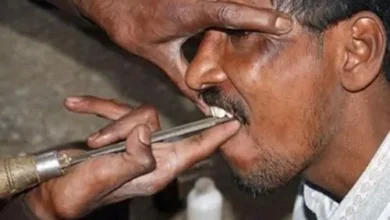 dentista20asiatico thumb5B45D