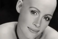 celebrities photoshopped bald 11 thumb