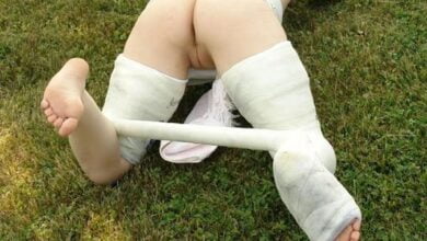 novinha no gesso 2 thumb1