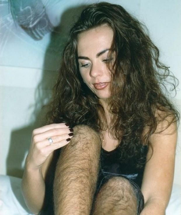 Peluda? Muito. Famosa? Também. E rica. Aceita que dói menos.