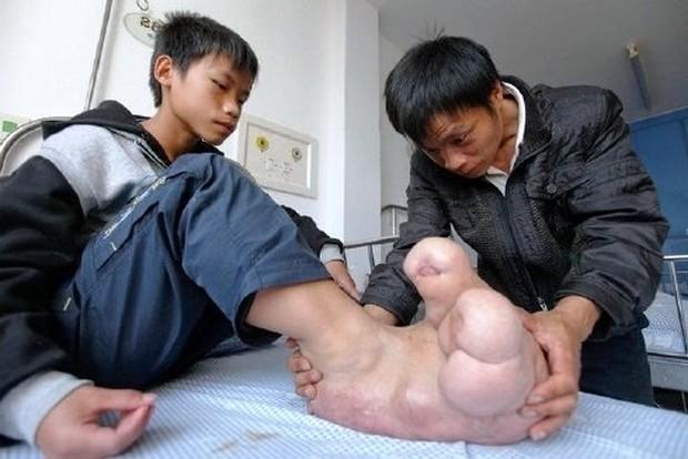 Dos pés gigantes à esperança: quando a medicina encontra a compaixão.