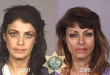 FacesofMethBeforeandAfterDeath 45 thumb