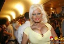 plasticsurgery10 thumb