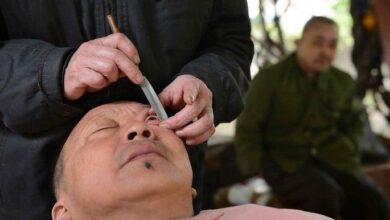 Limpeza de olhos nas ruas da China 11