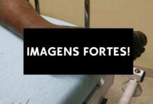 mendigo diabetico nao tirou o sapato por 10 anos inteiros