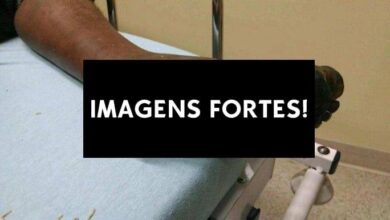 mendigo diabetico nao tirou o sapato por 10 anos inteiros