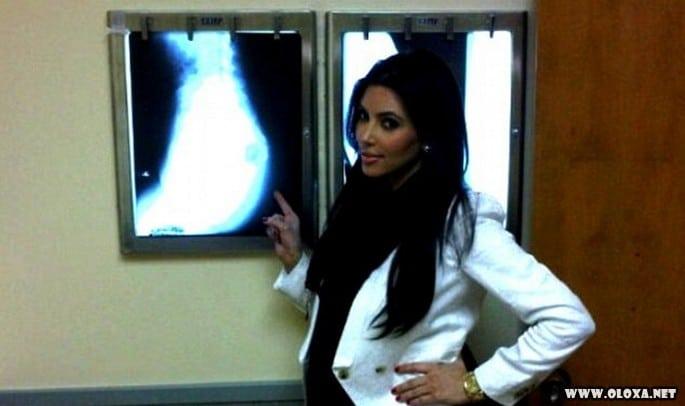 11 curiosidades sobre a bunda (3)