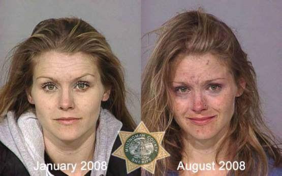 Faces-of-Meth-Before-and-After-Death_01