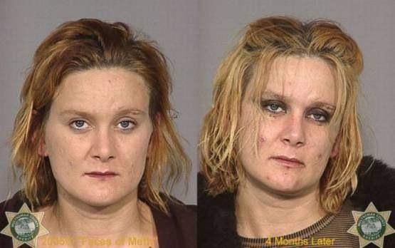 Faces-of-Meth-Before-and-After-Death_11