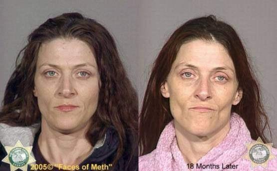 Faces-of-Meth-Before-and-After-Death_12