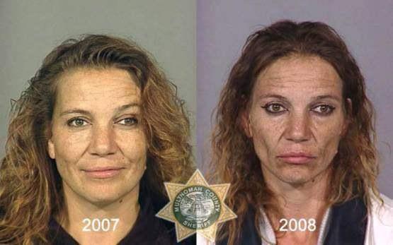 Faces-of-Meth-Before-and-After-Death_13