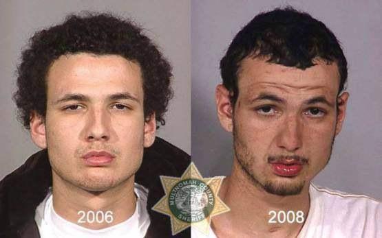 Faces-of-Meth-Before-and-After-Death_14
