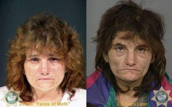 Faces-of-Meth-Before-and-After-Death_15