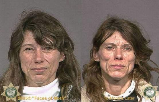 Faces-of-Meth-Before-and-After-Death_16