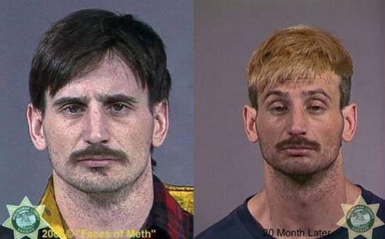 Faces-of-Meth-Before-and-After-Death_17