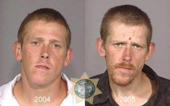 Faces-of-Meth-Before-and-After-Death_21