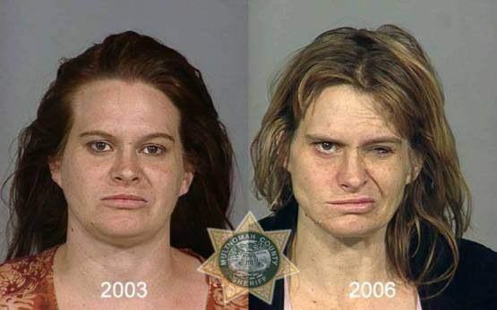 Faces-of-Meth-Before-and-After-Death_23