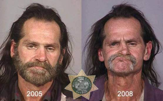 Faces-of-Meth-Before-and-After-Death_24
