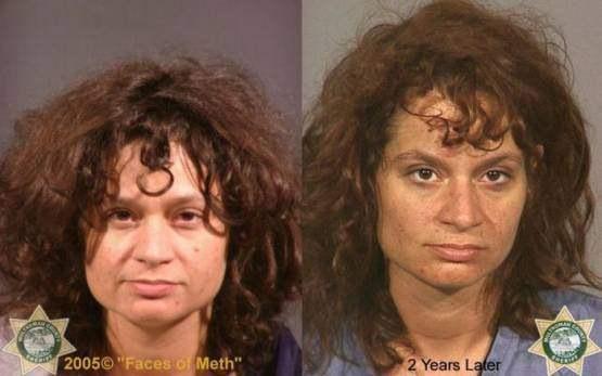 Faces-of-Meth-Before-and-After-Death_26