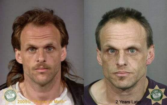 Faces-of-Meth-Before-and-After-Death_27