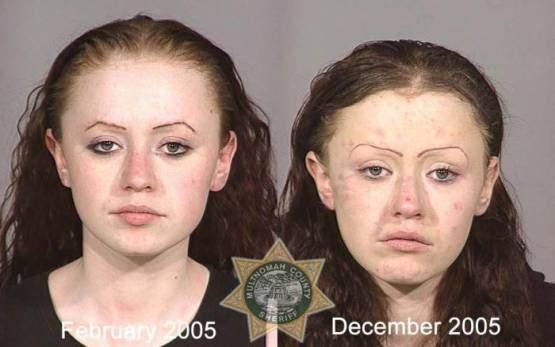 Faces-of-Meth-Before-and-After-Death_28
