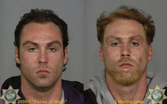 Faces-of-Meth-Before-and-After-Death_29