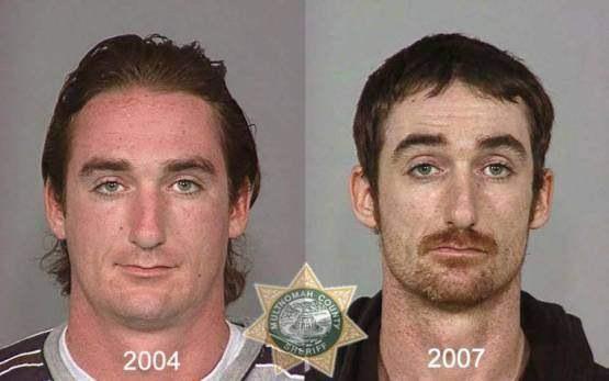 Faces-of-Meth-Before-and-After-Death_2