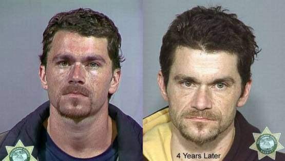 Faces-of-Meth-Before-and-After-Death_30