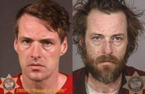 Faces-of-Meth-Before-and-After-Death_34