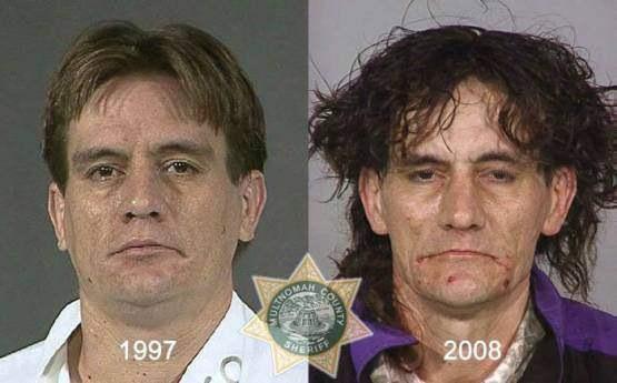Faces-of-Meth-Before-and-After-Death_35