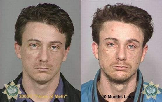 Faces-of-Meth-Before-and-After-Death_37