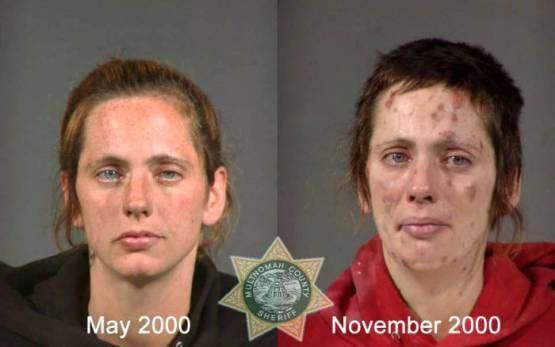 Faces-of-Meth-Before-and-After-Death_38