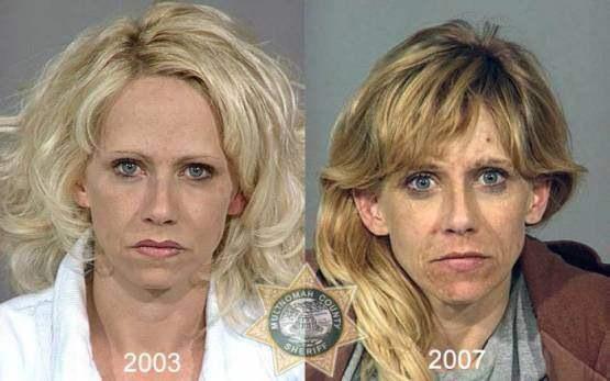 Faces-of-Meth-Before-and-After-Death_3