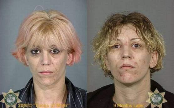Faces-of-Meth-Before-and-After-Death_40