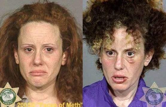 Faces-of-Meth-Before-and-After-Death_41