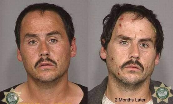 Faces-of-Meth-Before-and-After-Death_46