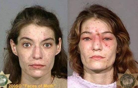 Faces-of-Meth-Before-and-After-Death_47