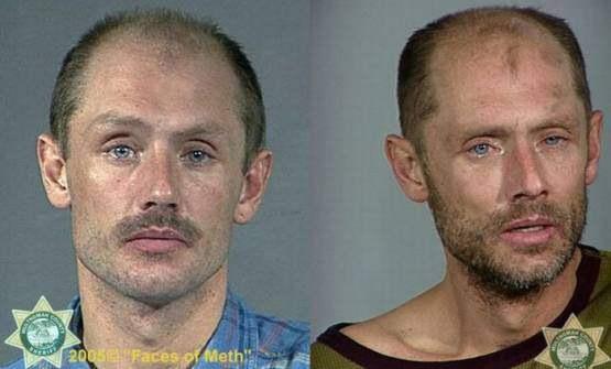 Faces-of-Meth-Before-and-After-Death_48