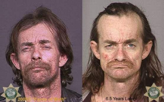 Faces-of-Meth-Before-and-After-Death_50