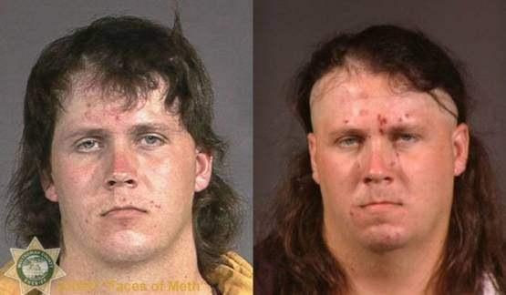 Faces-of-Meth-Before-and-After-Death_53
