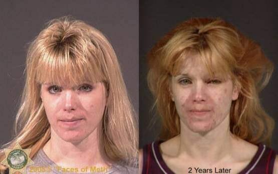 Faces-of-Meth-Before-and-After-Death_56