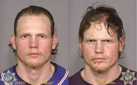 Faces-of-Meth-Before-and-After-Death_57