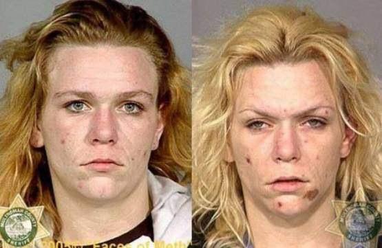 Faces-of-Meth-Before-and-After-Death_58
