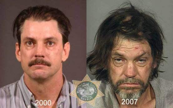 Faces-of-Meth-Before-and-After-Death_60