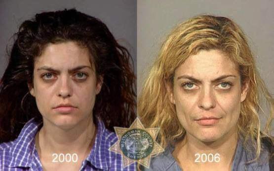 Faces-of-Meth-Before-and-After-Death_6