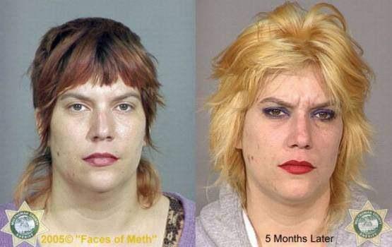 Faces-of-Meth-Before-and-After-Death_7