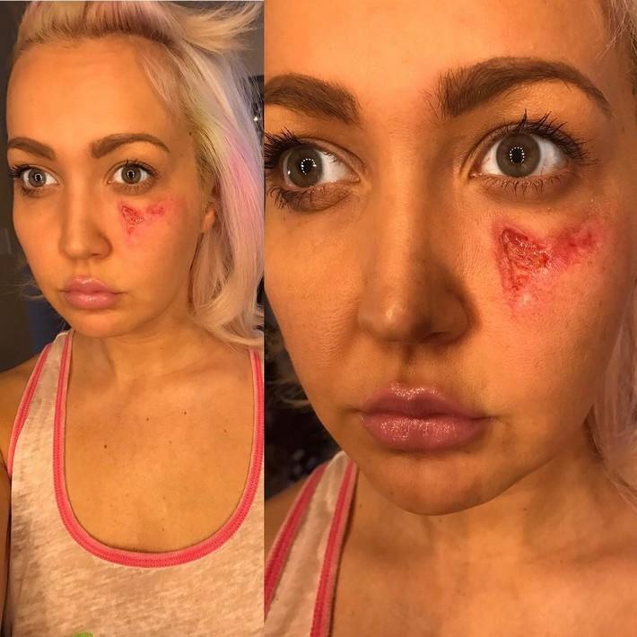 Mulher acorda com uma dor insuportavel furo no rosto e uma aranha na mao 2