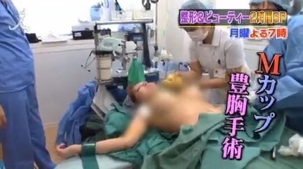 Mulher japonesa faz cirurgias para tornar se uma boneca francesa 9