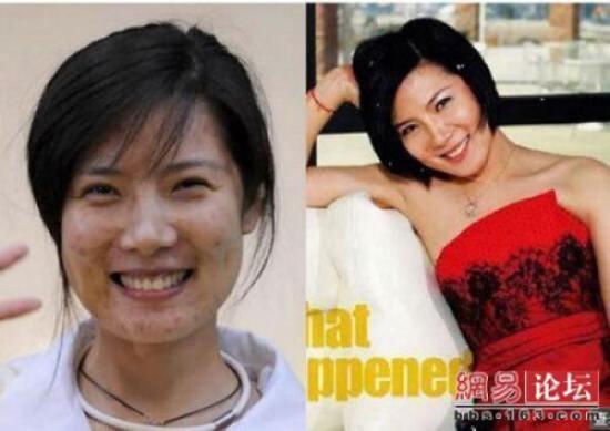 antes e depois com asiaticas (15)