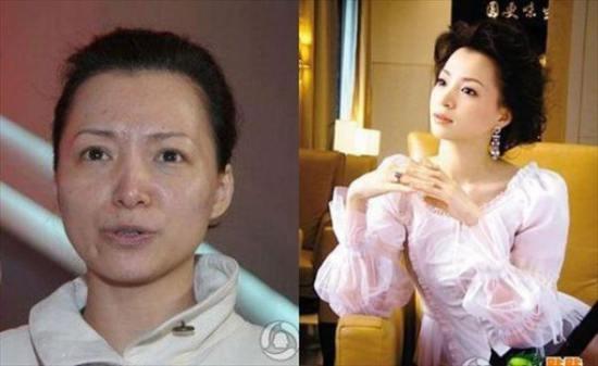 antes e depois com asiaticas (23)